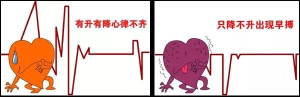 心脏骤停，体检可以预防吗